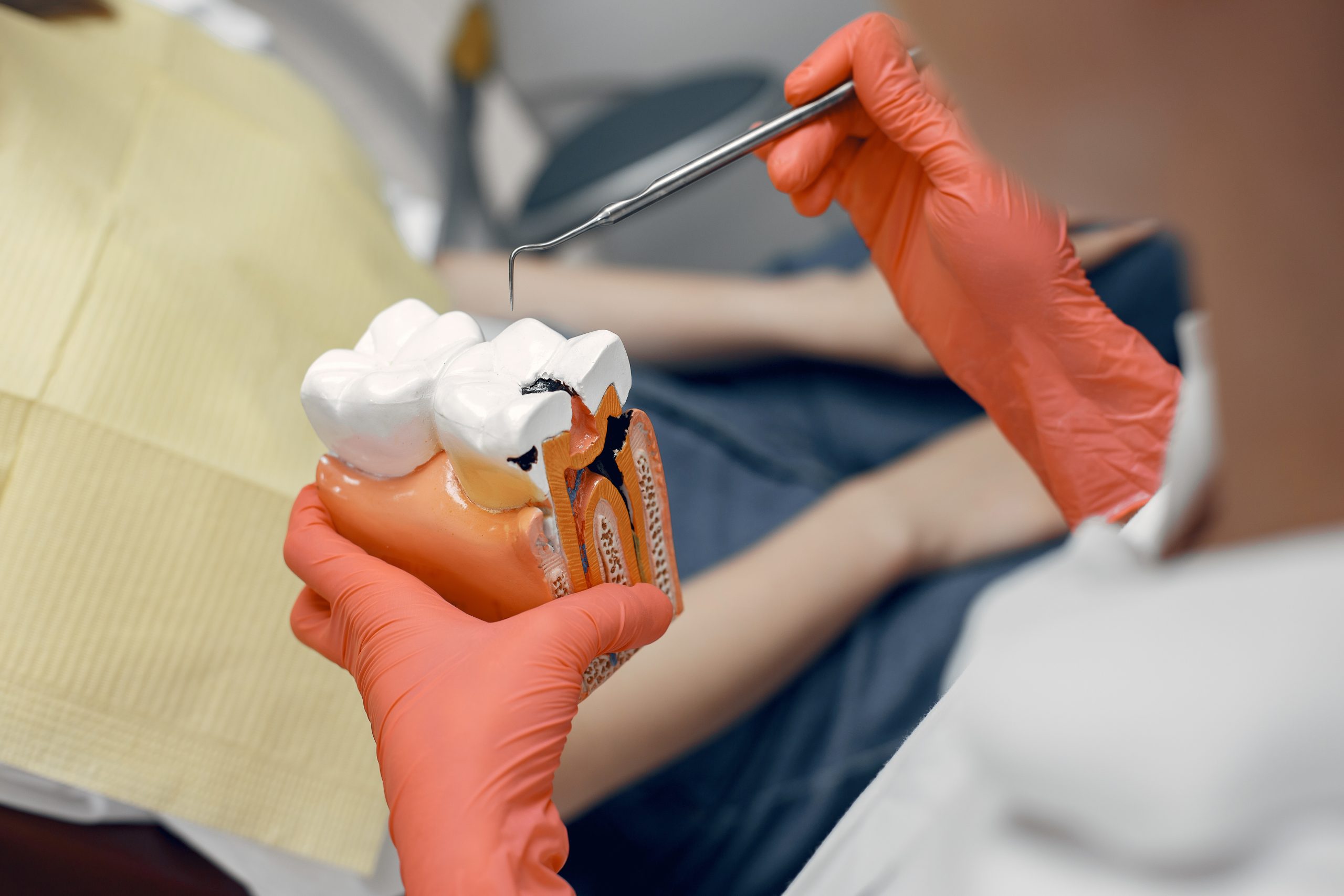 Root Canal Treatment: How It’s Done and When It’s Recommended